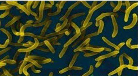 微生物菌劑好？好在哪里您知道嗎？